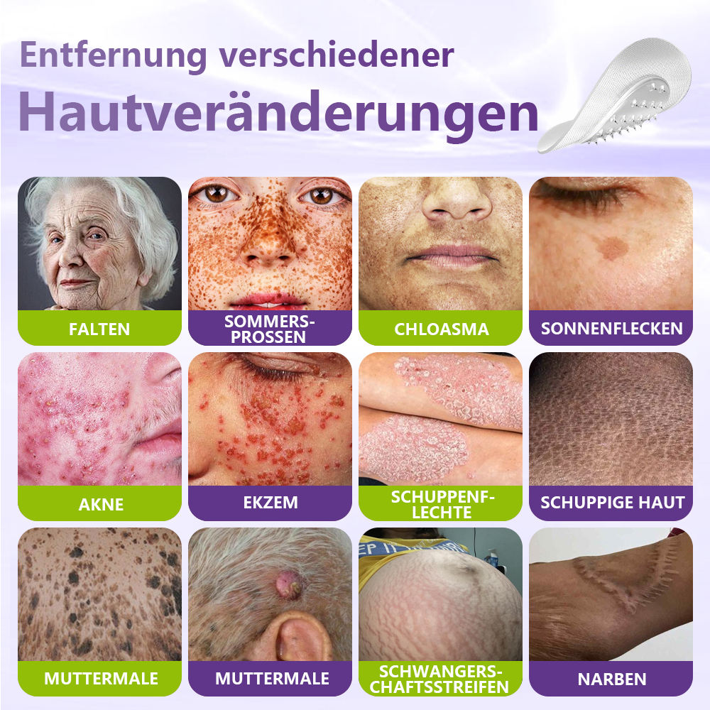 GFOUK® Lösliches Mikronadel-Pflaster zur Entfernung von Hautanhängseln auf Pflanzenbasis☘️