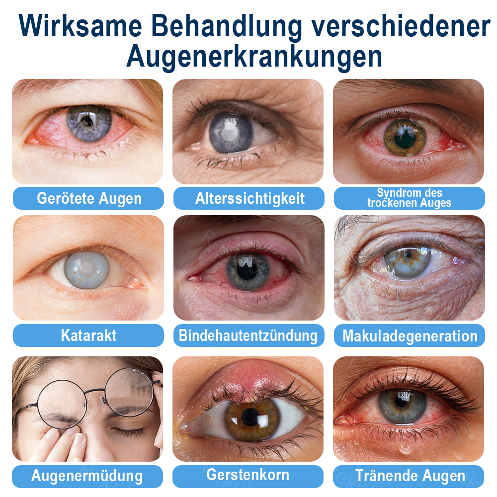 Rekulo® OptiMist Augenspray ✅ Für trockene Augen, verschwommene Sicht, Augenbelastung und Alterssichtigkeit up