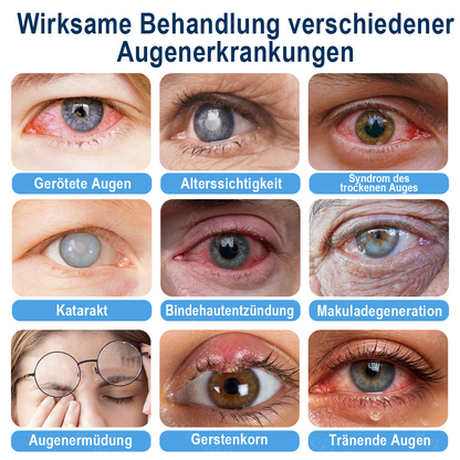 Rekulo® OptiMist Augenspray ✅ Für trockene Augen, verschwommene Sicht, Augenbelastung und Alterssichtigkeit up