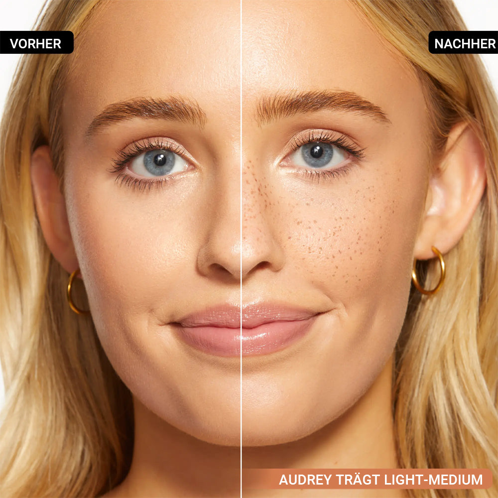 Rolimey® 5-Prong Sommersprossen-Stempel✨Natürlicher Sunkissed-Look in Sekunden