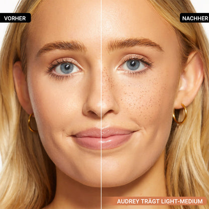 Rolimey® 5-Prong Sommersprossen-Stempel✨Natürlicher Sunkissed-Look in Sekunden