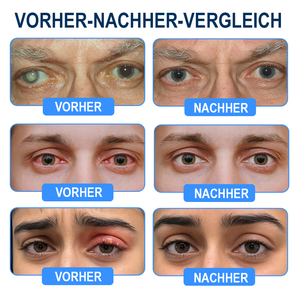Rekulo® OptiMist Augenspray ✅ Für trockene Augen, verschwommene Sicht, Augenbelastung und Alterssichtigkeit 👀