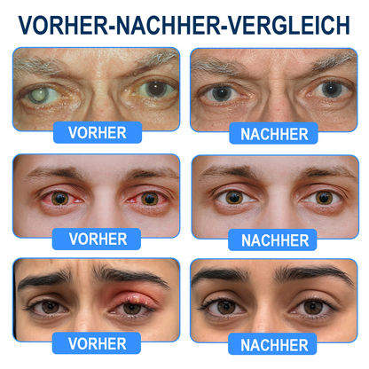 Rekulo® OptiMist Augenspray ✅ Für trockene Augen, verschwommene Sicht, Augenbelastung und Alterssichtigkeit 👀