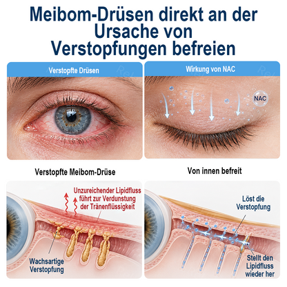 Rekulo® OptiMist Augenspray ✅ Für trockene Augen, verschwommene Sicht, Augenbelastung und Alterssichtigkeit 👀🍀